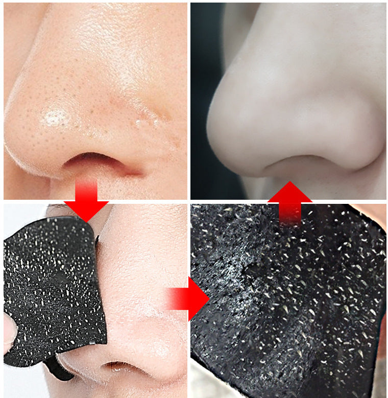 Hot-selling Blackhead and Acne Removal Nose Strips BLACKHEAD MASK 5PCS 10PCS 15PCS 20PC