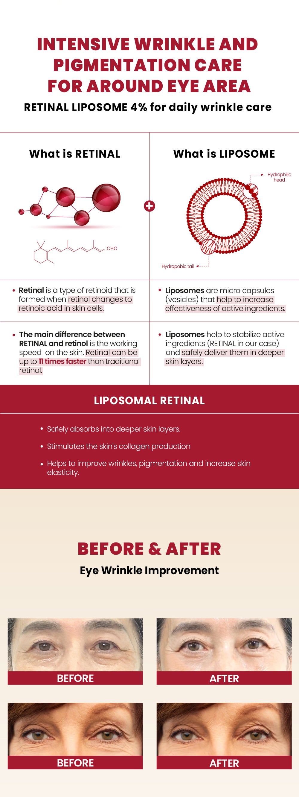 Cross-Border South Korea Seoul 1988 Eye Cream Retinal Eye Cream Liposomes4%Eye Cream Retinol Eye Cream