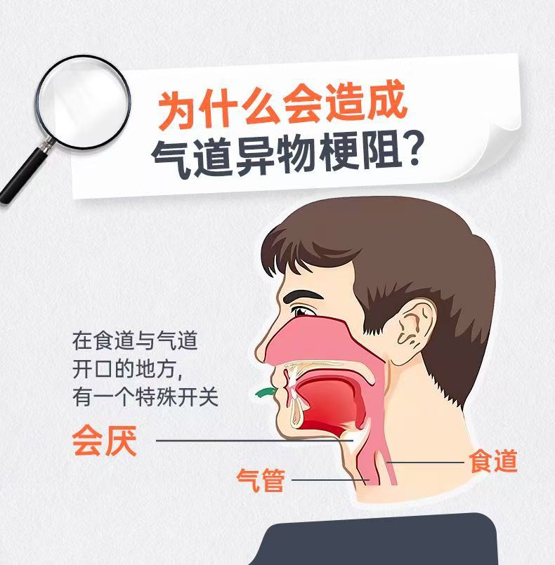 Heimlich Emergency Device Artifact Fully Automatic Anti-Choke Device Portable Throat Negative Pressure Aspirator for Children Stuck Throat
