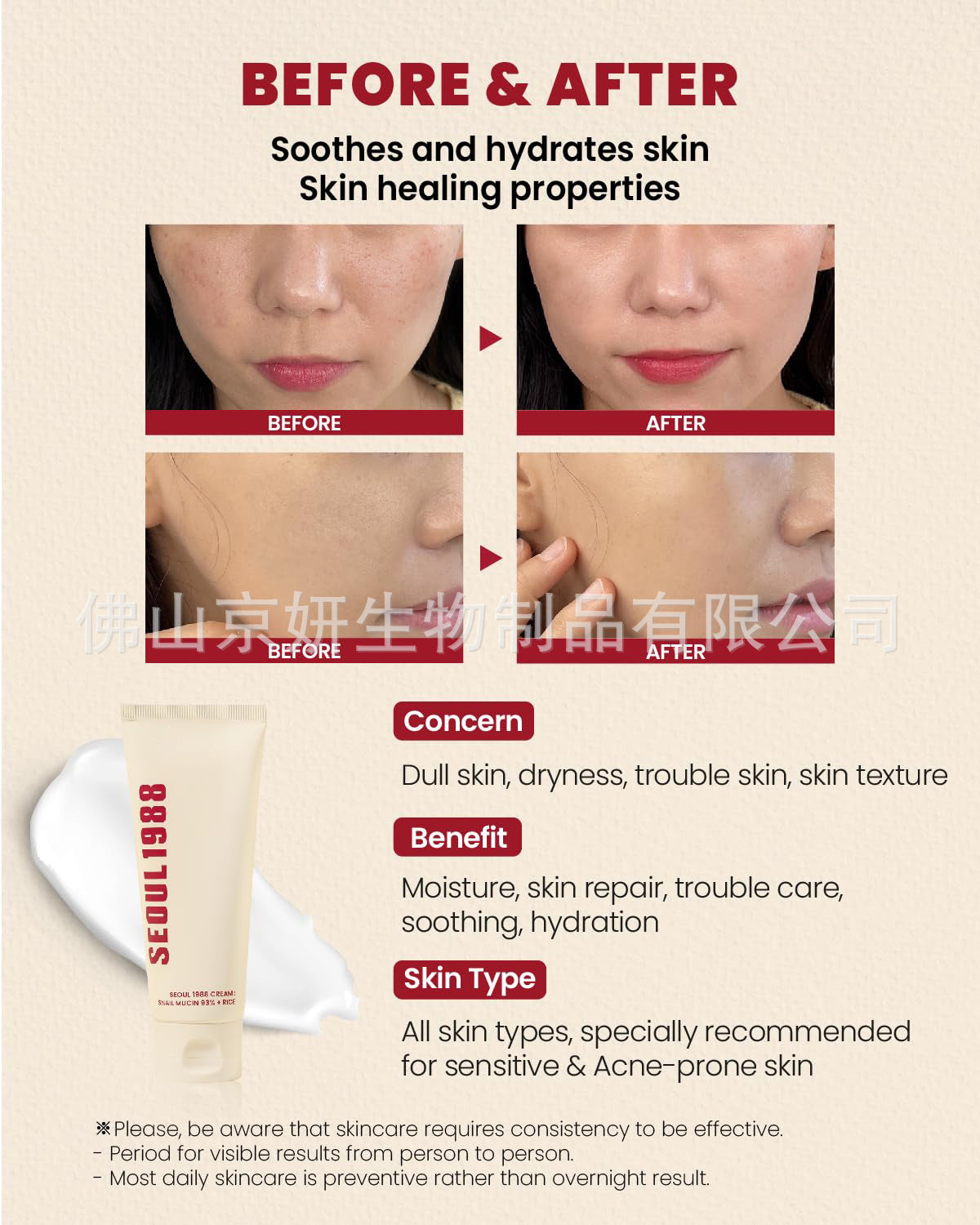 Cross-Border South Korea Seoul 1988 Eye Cream Retinal Eye Cream Liposomes4%Eye Cream Retinol Eye Cream