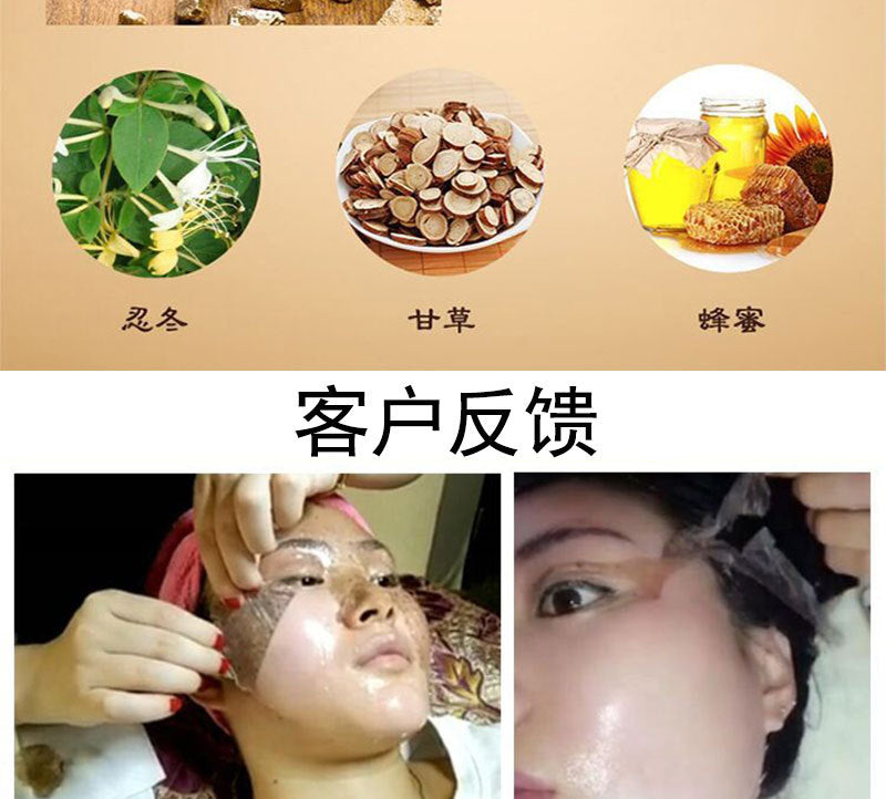 Pore Cleansing Peel Mask for Freckles, Dark Spots, Dullness Improvement, Whitening, Blackhead and Acne Removal, Peel-off Mask, Spot Absorbing Mask