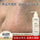 Professional Blackhead Removal Skincare Set – Blackhead Serum, Nose Strips & Pore Cleanser