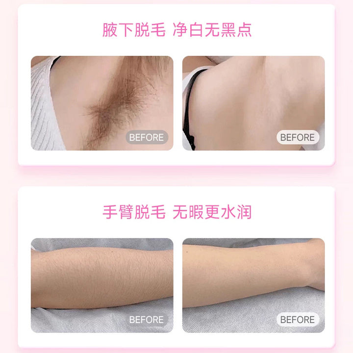 Women's Underarm Hair Removal Cream – No Black Dot Gentle Sensitive Skin Formula