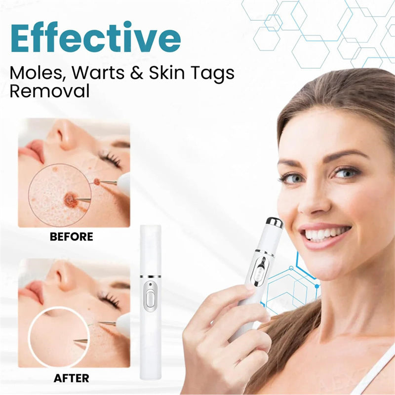 Mole and Wart Removal Pen 皮肤护理笔   清洁平滑呵护肌肤