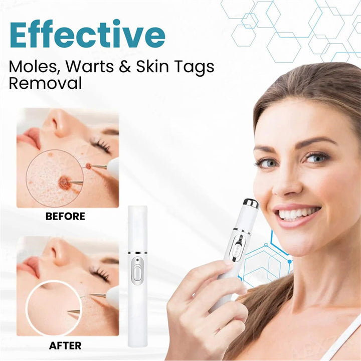 Mole and Wart Removal Pen 皮肤护理笔   清洁平滑呵护肌肤