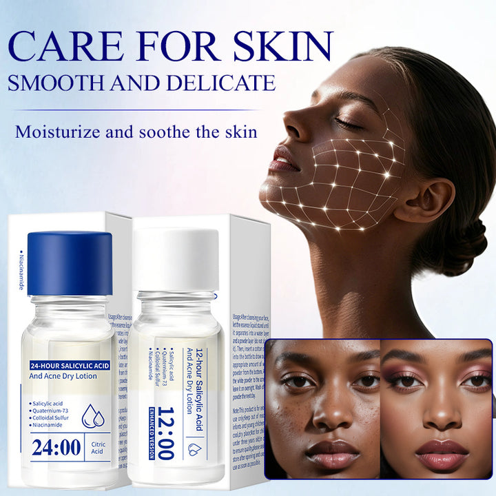 24 Acne Dry Lotion