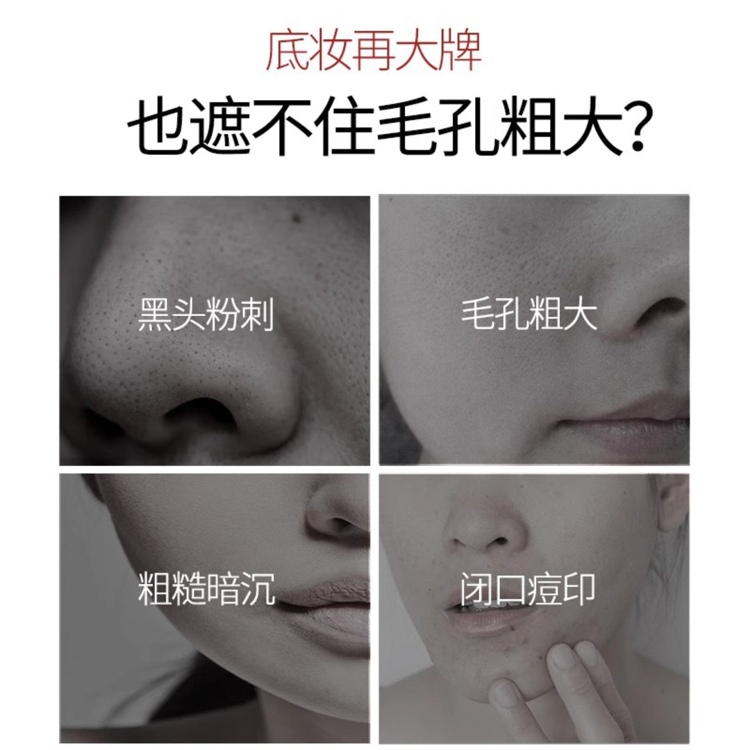 Professional Blackhead Removal Skincare Set – Blackhead Serum, Nose Strips & Pore Cleanser