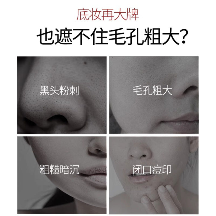 Professional Blackhead Removal Skincare Set – Blackhead Serum, Nose Strips & Pore Cleanser