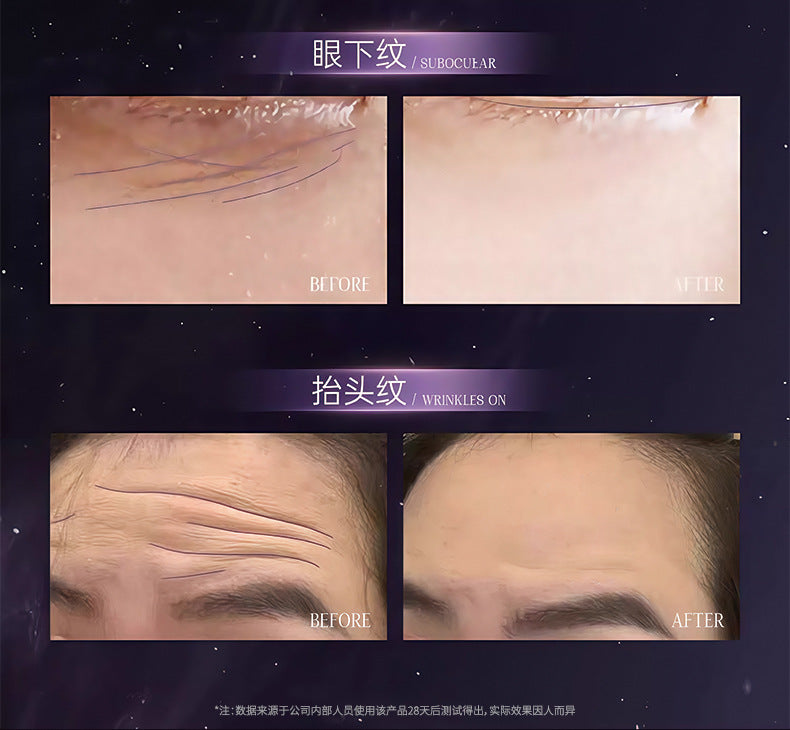 Fushiting Caffeine Anti-Wrinkle Eye Cream for Fine Lines, Dark Circles, Eye Bags, Lifting and Firming Eye Area