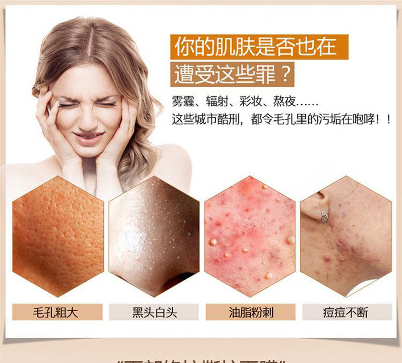 Pore Cleansing Peel Mask for Freckles, Dark Spots, Dullness Improvement, Whitening, Blackhead and Acne Removal, Peel-off Mask, Spot Absorbing Mask