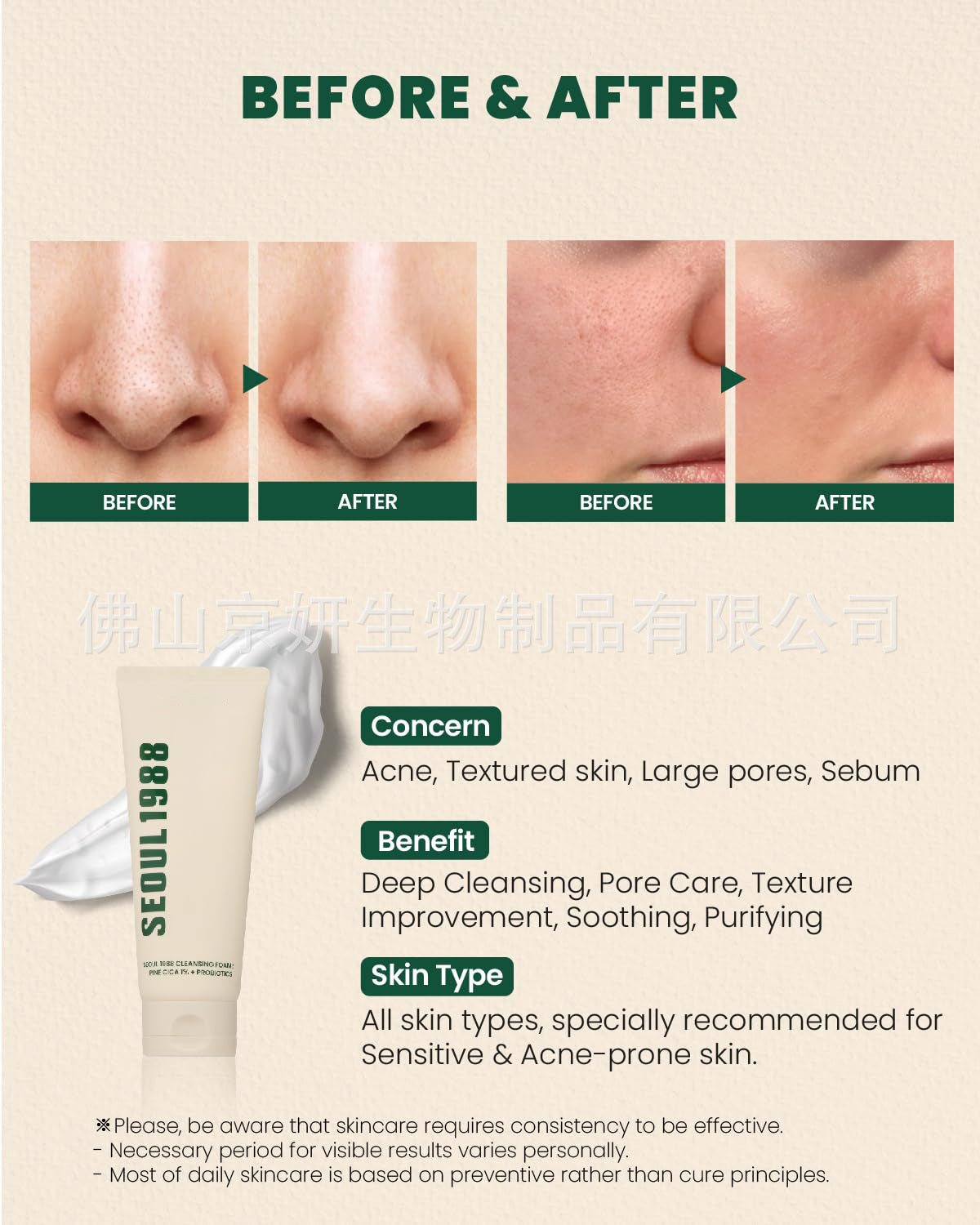 Cross-Border South Korea Seoul 1988 Eye Cream Retinal Eye Cream Liposomes4%Eye Cream Retinol Eye Cream